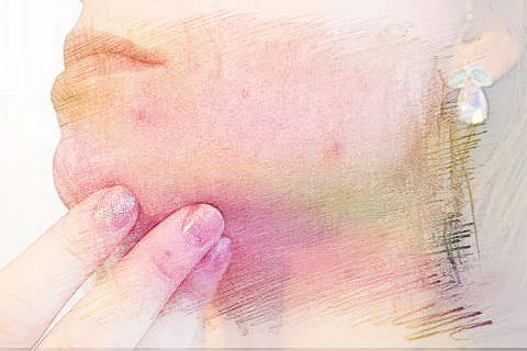 梦见脸上长痘痘　周公解梦之梦到脸上长痘痘