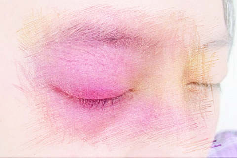 梦见眼睛肿了　周公解梦之梦到眼睛肿了