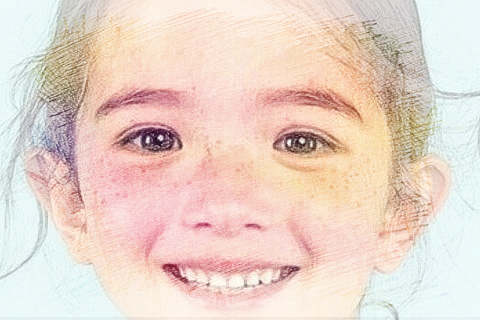 梦见脸上长斑　周公解梦之梦到脸上长斑