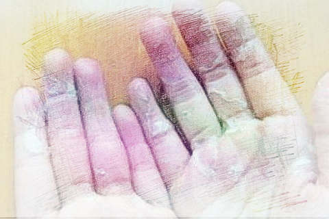 梦见自己脱皮　周公解梦之梦到自己脱皮