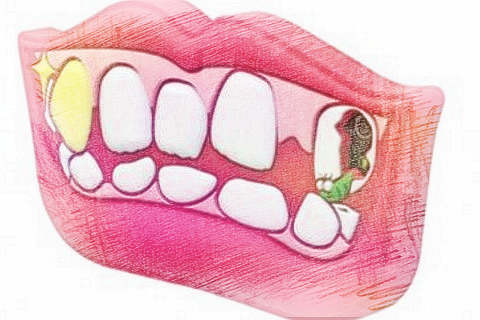 梦见牙齿有洞　周公解梦之梦到牙齿有洞