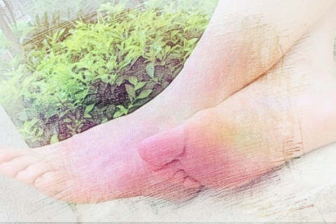 梦见脚脱皮　周公解梦之梦到脚脱皮