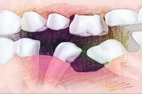 梦见下牙松动　周公解梦之梦到下牙松动