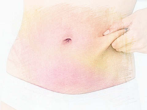 梦见肚子　周公解梦之梦到肚子