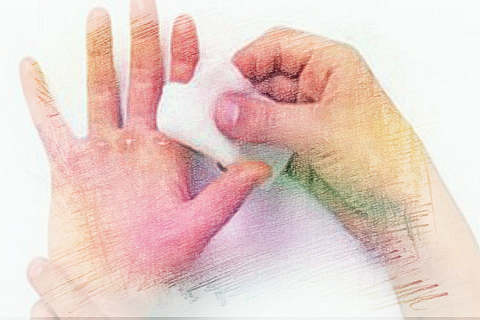 梦见被火烫伤　周公解梦之梦到被火烫伤