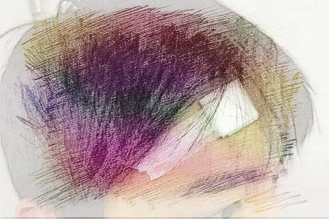 梦见额头流血　周公解梦之梦到额头流血