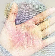 梦见手蜕皮　周公解梦之梦到手蜕皮