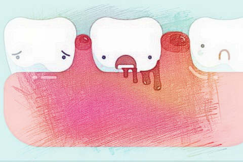 梦见牙龈出血　周公解梦之梦到牙龈出血