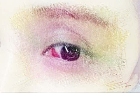 梦见眼睛出血　周公解梦之梦到眼睛出血