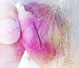 梦见左耳流血　周公解梦之梦到左耳流血