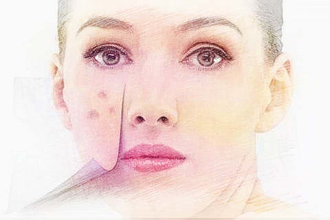 梦见脸长痘痘　周公解梦之梦到脸长痘痘