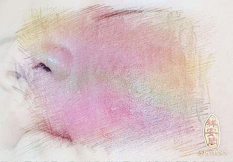 梦见脸上长癣　周公解梦之梦到脸上长癣