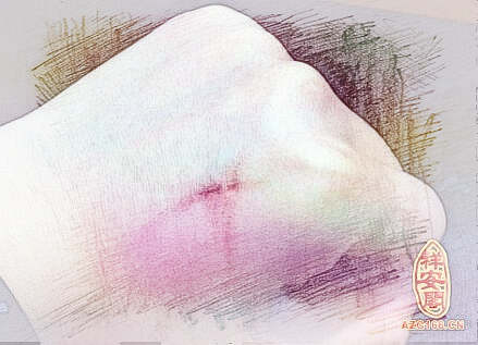 梦见左手受伤　周公解梦之梦到左手受伤