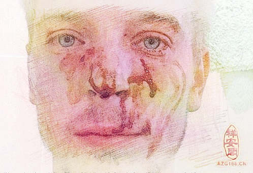 梦见满脸是血　周公解梦之梦到满脸是血