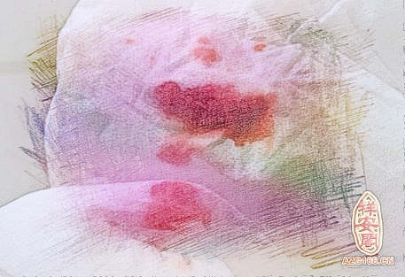 梦见小便有血　周公解梦之梦到小便有血