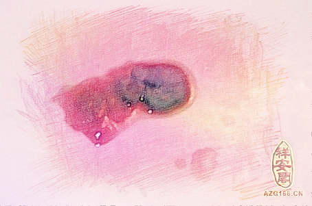 梦见大便带血　周公解梦之梦到大便带血