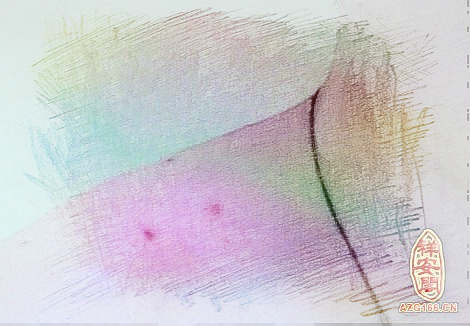 梦见身上长痘　周公解梦之梦到身上长痘