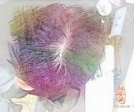 梦见头发秃了　周公解梦之梦到头发秃了