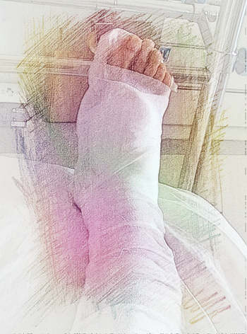 梦见腿骨折了　周公解梦之梦到腿骨折了