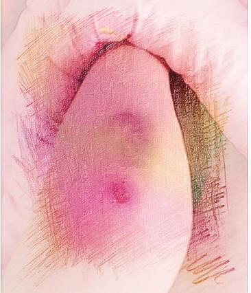 梦见腿痛　周公解梦之梦到腿痛