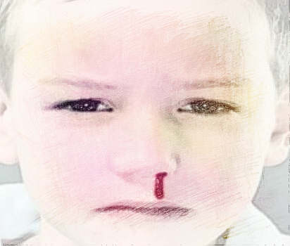 梦见耳鼻出血　周公解梦之梦到耳鼻出血