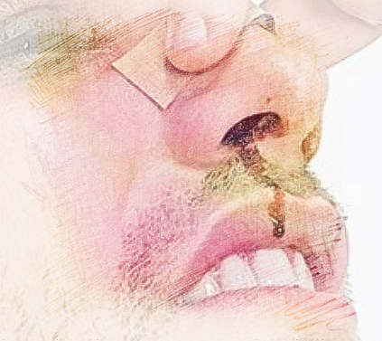 梦见鼻出血了　周公解梦之梦到鼻出血了