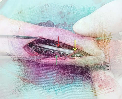 梦见脚受了伤　周公解梦之梦到脚受了伤