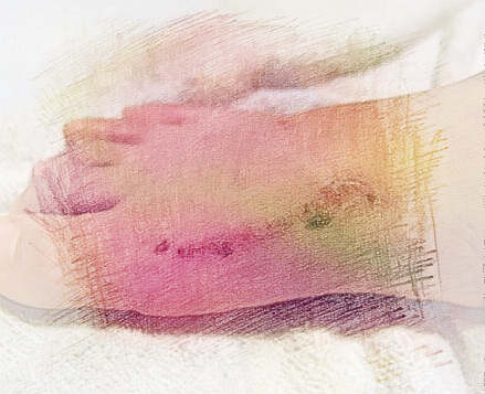 梦见脚流血了　周公解梦之梦到脚流血了