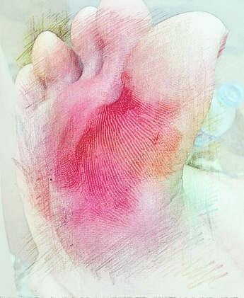 梦见脚有伤　周公解梦之梦到脚有伤