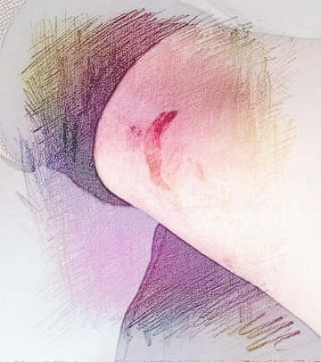 梦见腿流血了　周公解梦之梦到腿流血了