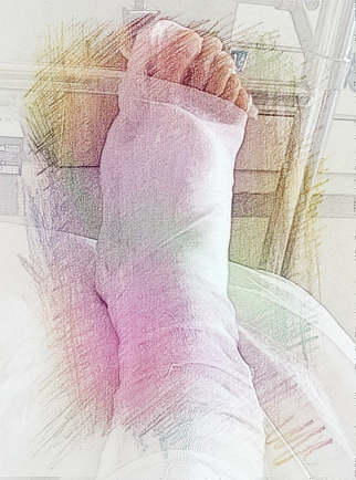 梦见腿骨折断　周公解梦之梦到腿骨折断