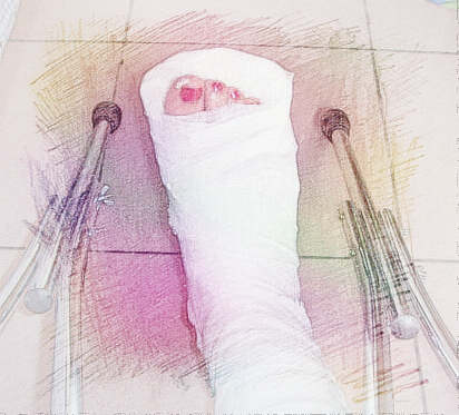 梦见腿在受伤　周公解梦之梦到腿在受伤