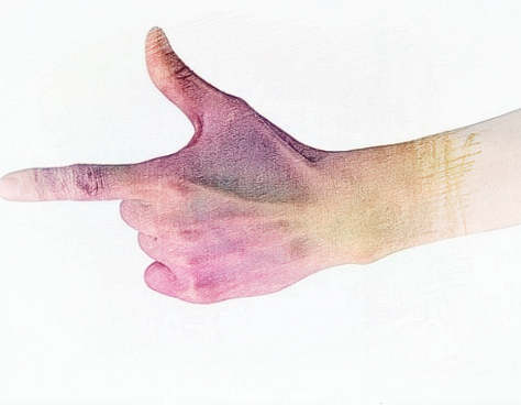 梦见手心有血　周公解梦之梦到手心有血