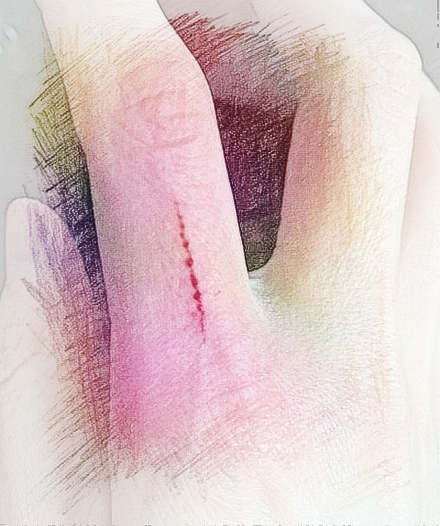 梦见手划破　周公解梦之梦到手划破