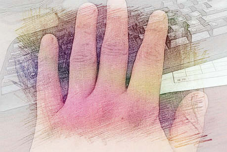 梦见手指发黑　周公解梦之梦到手指发黑