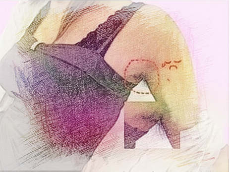 梦见阴毛 腋毛　周公解梦之梦到阴毛 腋毛