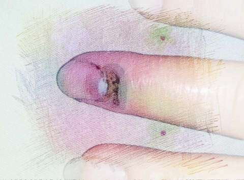 梦见手指流浓　周公解梦之梦到手指流浓