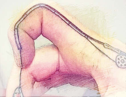 梦见手指腐烂　周公解梦之梦到手指腐烂