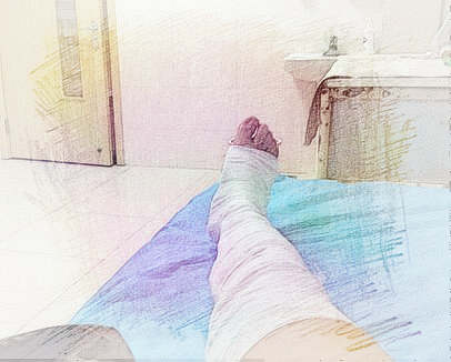 梦见腿摔断了　周公解梦之梦到腿摔断了