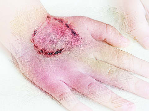 梦见手被咬　周公解梦之梦到手被咬