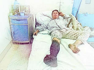 梦见蛇咬腿　周公解梦之梦到蛇咬腿