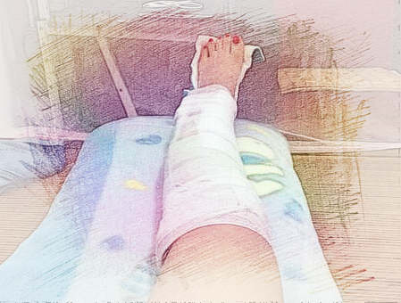 梦见腿有伤口　周公解梦之梦到腿有伤口