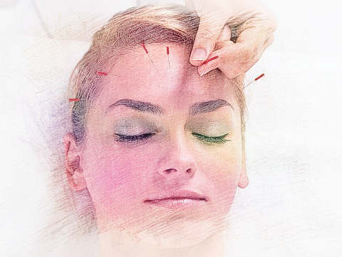 梦见针扎头部　周公解梦之梦到针扎头部