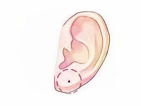 梦见耳朵长痣　周公解梦之梦到耳朵长痣