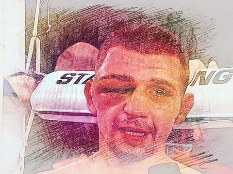 梦见眼睛打肿　周公解梦之梦到眼睛打肿