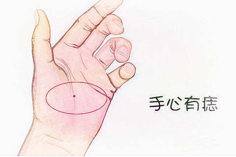 梦见手心有痣　周公解梦之梦到手心有痣