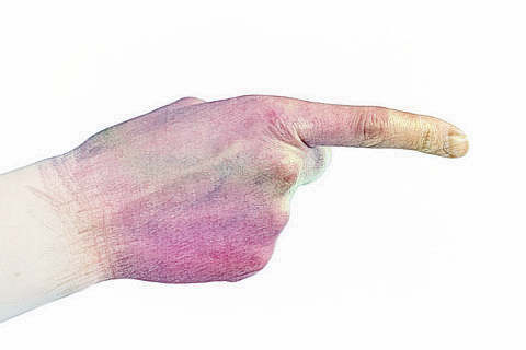 梦见手指有电　周公解梦之梦到手指有电