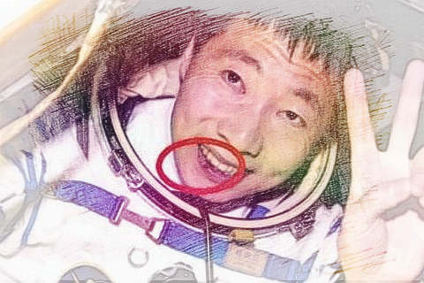 梦见嘴受伤　周公解梦之梦到嘴受伤