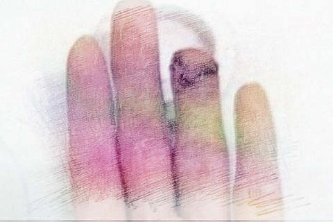 梦见手腐烂了　周公解梦之梦到手腐烂了