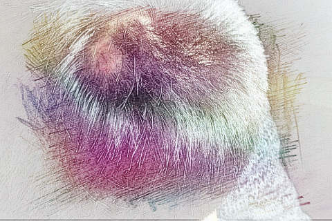 梦见头顶有疤　周公解梦之梦到头顶有疤